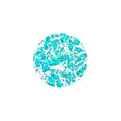 GMS Stain Kit (Modified Gomori)